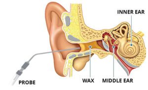 A diagram of the ear and its parts